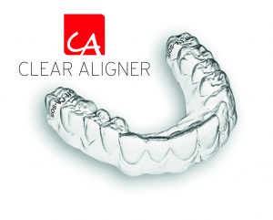 Przezroczyste szyny korygujące wady zgryzu Clear Alinger - Scheu Dental