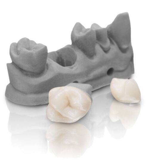 VarseoSmile Crown Plus