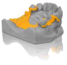VarseoWax CAD/Cast - żywica spalająca się bezresztkowo