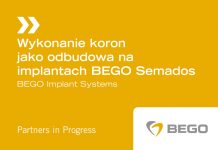 Wykonanie koron jako odbudowa na implantach BEGO Semados – szkolenie 1 stopnia
