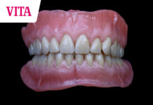 Make it pink! – Szybka i prosta charakteryzacja protez za pomocą kompozytu VM LC i farb Akzent LC