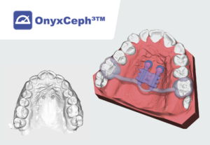 OnyxCeph Aparaty CAD/CAM drukowane z metalu SLM