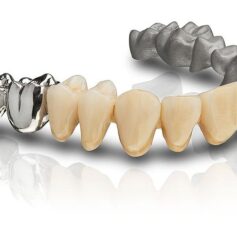 mediloy-s-co stop dentystyczny SLM