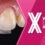 VITA EXCELLENCE AWARD 2027 – VITA ENAMIC